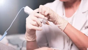 آیا کرایوتراپی زگیل تناسلی درد دارد